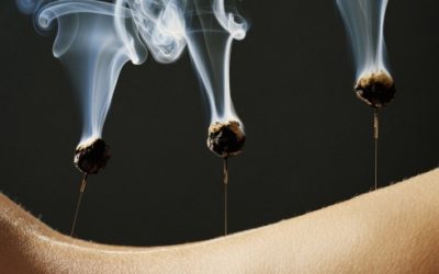 Acupuncture Moxibustion