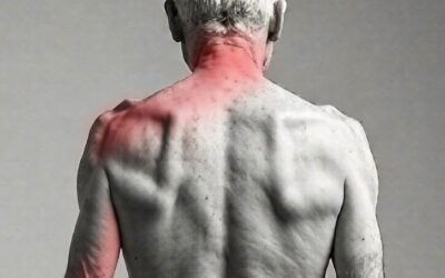 Cas Clinique de Névralgie cervico-brachiale